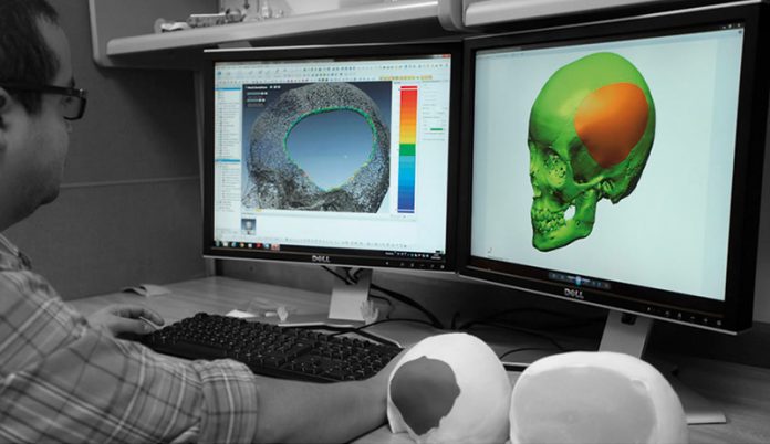 Implantes craneales Implantes craneales